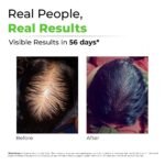 Avimee Herbal Scalptone Hair Growth Serum | Scientifically Proven Formula | Enriched with Nansyl & Green Tea Extract | For Hair Growth & Hair Fall Reduction (Pack of 1) - Image 4