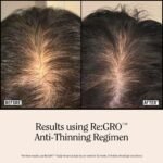 California Naturals Women's ReGRO Anti-Thinning Scalp Serum, 5% Capixyl with Biotin, Caffeine & Castor and Rosemary Oil, Non-Sticky Cooling Formula, Vegan & Cruelty Free, 3oz - Image 10