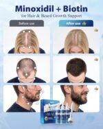5% Minoxidil Hair Regrowth Treatment for Men and Women with Biotin - Extra Strength Hair Growth Serum, Dropper 3 Pack, Beard Growth, Thinning Hair & Receding Hairline, Unscented, 6 FL OZ - Image 3