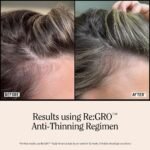 California Naturals Women's ReGRO Anti-Thinning Scalp Serum, 5% Capixyl with Biotin, Caffeine & Castor and Rosemary Oil, Non-Sticky Cooling Formula, Vegan & Cruelty Free, 3oz - Image 8