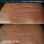 RoC Derm Correxion Fill+Treat Retinol Serum, Deep Wrinkle Filler for Face - Image 6