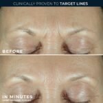 RoC Derm Correxion Fill+Treat Retinol Serum, Deep Wrinkle Filler for Face - Image 5