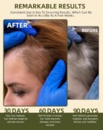 100% Natural Pure Batana Oil for Hair Growth,4.23 Fl Oz (Pack of 1) - Image 3