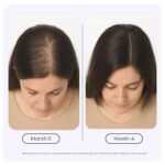 Growplex Rosemary Elixir – Daily Scalp Oil with 9 Essential Oils – Lightweight, Non-Greasy Formula for a Healthy-Looking Scalp – For Men & Women – 2oz - Image 4