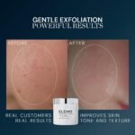 ELEMIS Dynamic Resurfacing Facial Pads, Gentle Textured Treatment - Image 3