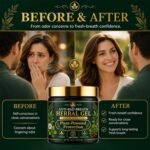 Herbal Gel for Bad Breath, Bad Breath Treatment for Adults - Image 3