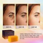 VALITIC Kojic Acid Dark Spot Remover Soap Bars, Turmeric Bar Soaps 2 Pack - Image 2