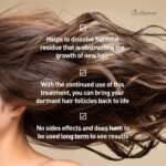 Grow New Hair Treatment | Hair Regrowth Oil | Natural Hair Care | Hair Growth Treatment For Men and Women | Just Nutritive | 4 Oz - Image 3