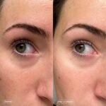 Topicals, Faded Brightening Under Eye Masks, Depuffs & Brightens, Set of 6 - Image 5