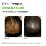 AVIMEE HERBAL Keshpallav Hair Oil, Men & Women, Pack of 3 - Image 3