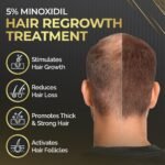 Elevate Hair Regrowth Treatment 5% Minoxidil Solution for Hair Growth - Extra Strength Topical Hair Growth Serum for Thicker, Fuller Hair 2 Fl Oz Made in USA - Image 5