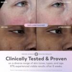 Olay Super Serum - Glow Serum for Face - Activated Niacinamide, Vitamin C & E, Collagen Peptide, AHA - 5-in-1 Benefits - Brightens, Hydrates, Smooths, Firms, Evens Tone, Proactive Anti-Aging, 1.7 Oz - Image 5