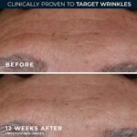 RoC Retinol Correxion Deep Wrinkle Retinol Face Serum, Ascorbic Acid, 1 0z - Image 5