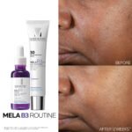 La Roche-Posay Mela B3 Niacinamide Serum, Anti-Aging Dark Spot Corrector - Image 6